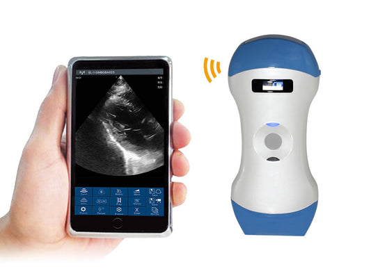 Scanner de ultrassom portátil 3 em 1 sem fio com sonda, compatível com iOS, Android e Windows.
