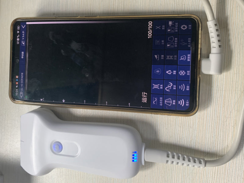 linear USB probe handheld color ultrasound, supporting USB + wireless WiFi connectivity (96E)